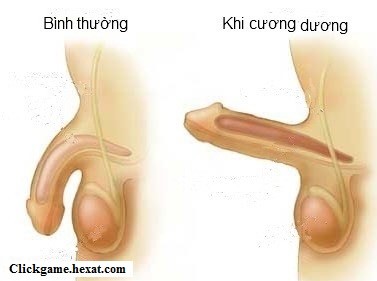 Nguyên nhân, cơ chế dương vật cương – xìu